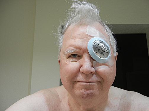 Eye shield